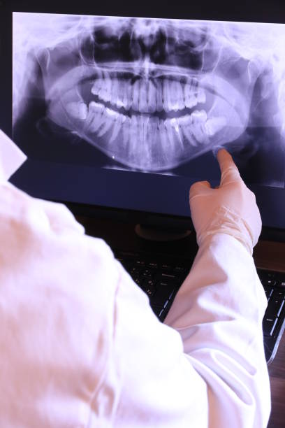 Best Emergency Wisdom Teeth Removal in Elk Plain, WA